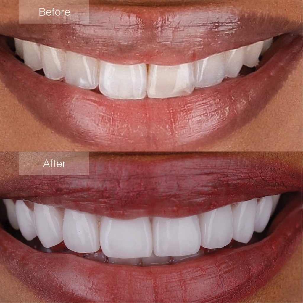 Dental Services Coverley Dental Barbados Family Dental...