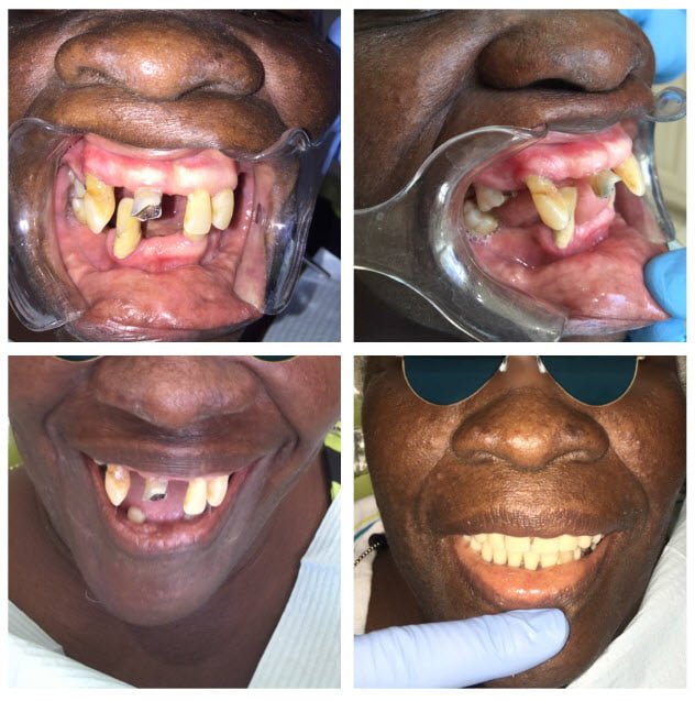 dental-surgery-8
