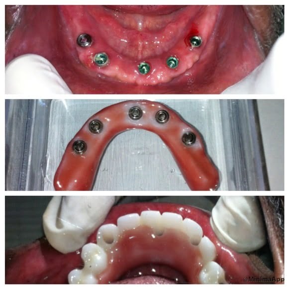 dental-surgery-31