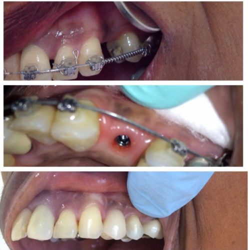 dental-surgery-21