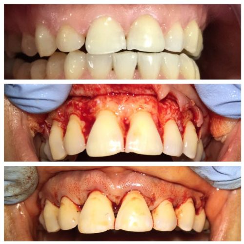 dental-surgery-3