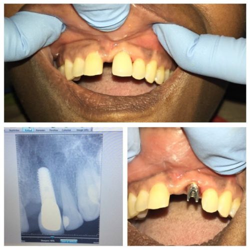 dental-surgery-4
