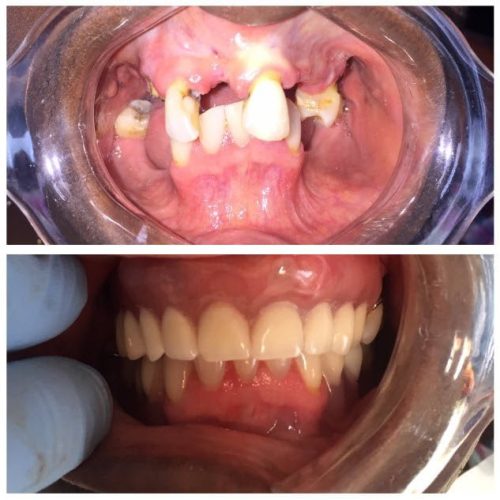 dental-surgery-6