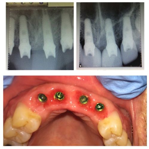 dental-surgery-10