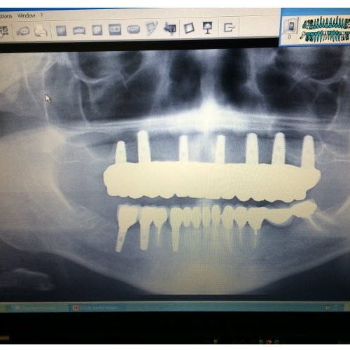 dental-surgery-14