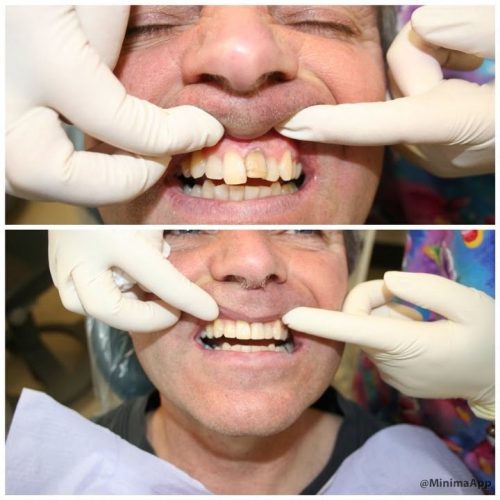 dental-surgery-28